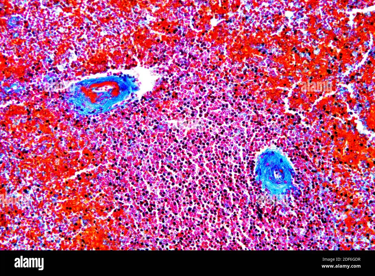 herzwurm unter mikroskop